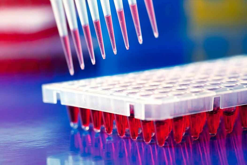exame de sangue imunoensaio para parasitas