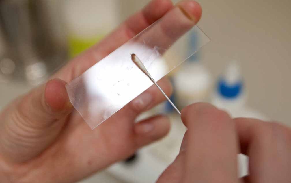 raspagem para detectar a presença de parasitas no corpo