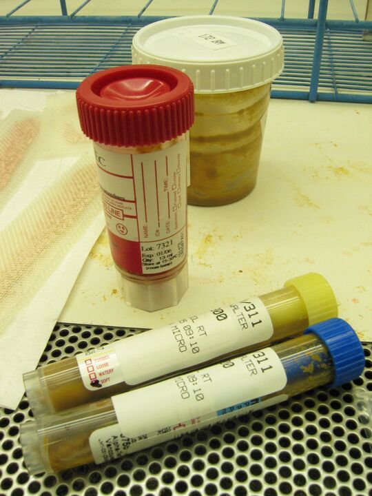 testes para detectar parasitas